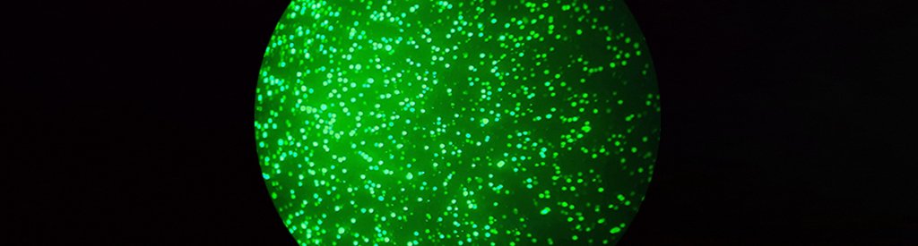 Freshly transfected CHO cells under the microscope